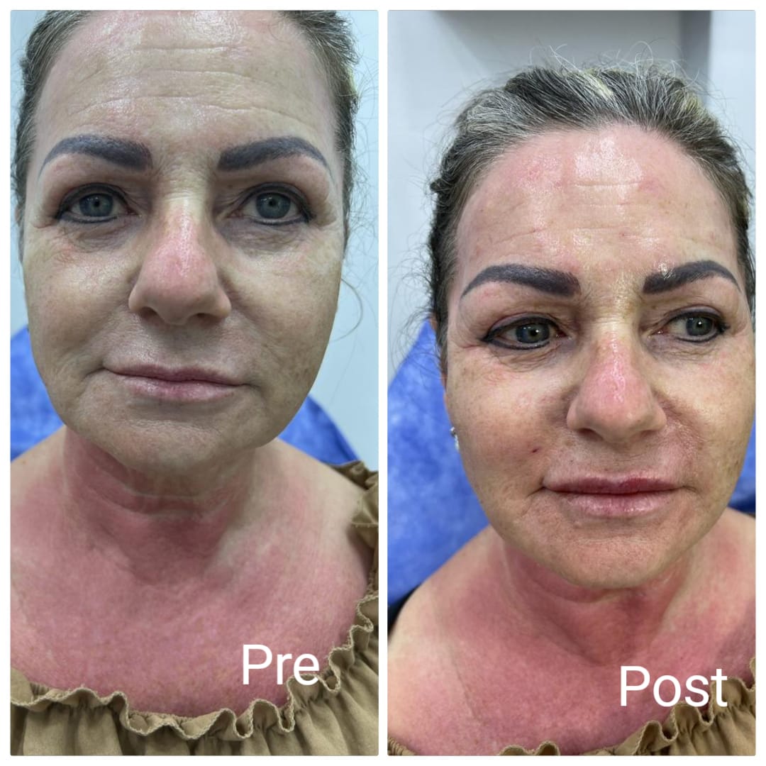 Skin care at Nadara Beauty Salon